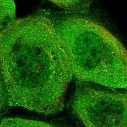 PHLDB3 Antibody, Novus Biologicals 25 &mu;L | Buy Online | Novus Biologicals | Fisher Scientific